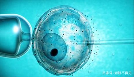 体外受精 IVF-ET